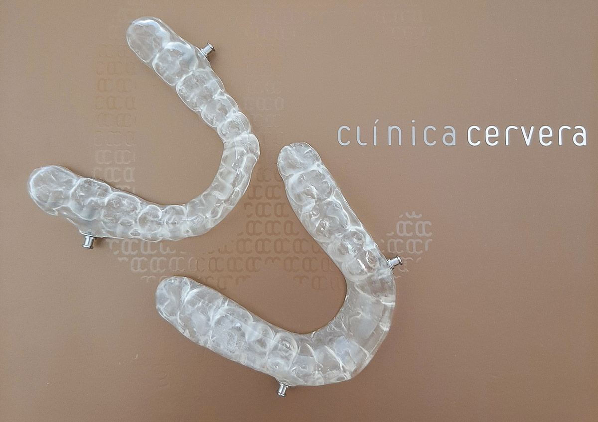 RoncoApnea - ➡️ DAM: Dispositivo de Avance Mandibular